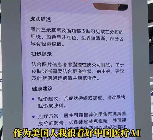博主坦言美国看病太贵太麻烦:想把中国的AI医生带回去