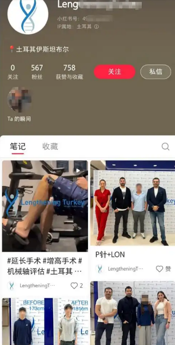 “断骨增高术”隐蔽宣传在国内死灰复燃:专家揭秘手术过程 风险巨大